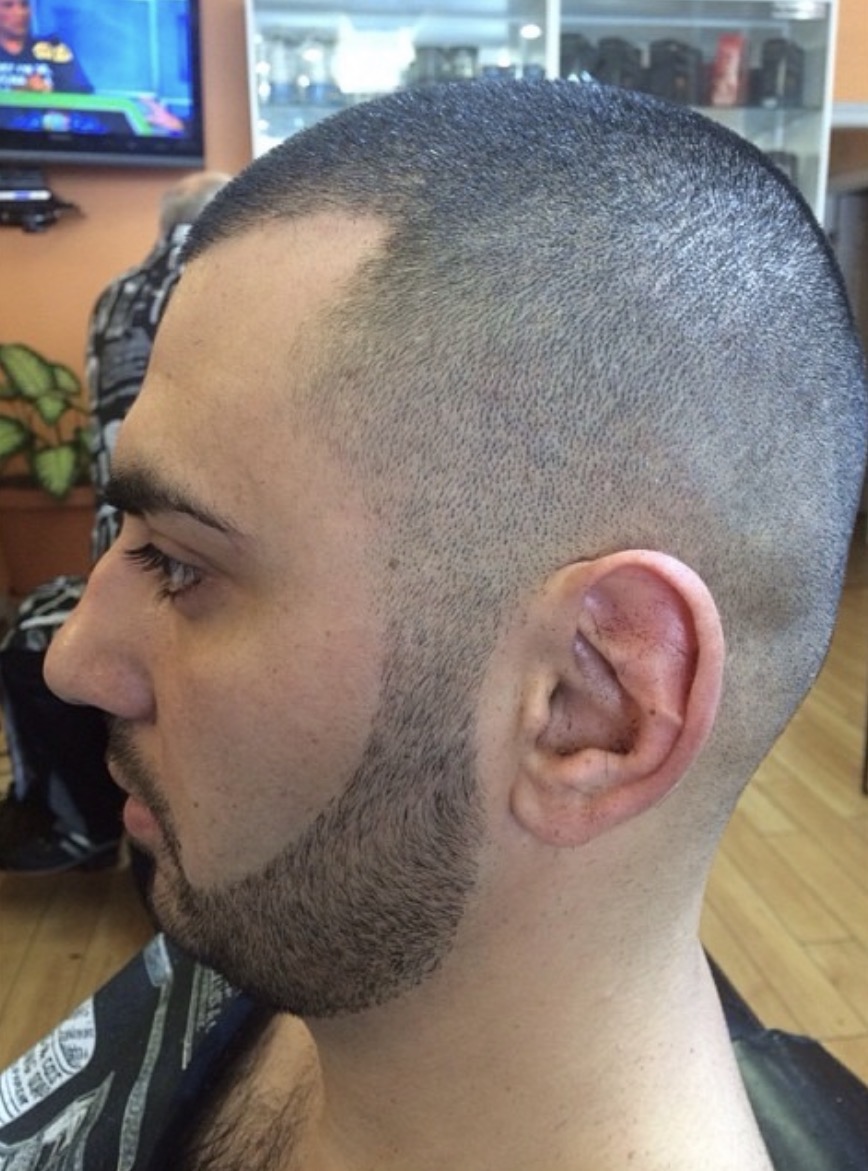 Bald fade with sculpted beard lineup